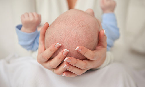 PLAGIOCEPHALY